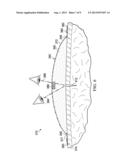 REDUCED-PRESSURE DRESSING ASSEMBLIES FOR USE IN APPLYING A CLOSING FORCE diagram and image