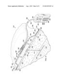 REDUCED-PRESSURE DRESSING ASSEMBLIES FOR USE IN APPLYING A CLOSING FORCE diagram and image