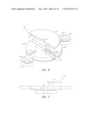 Low Profile Instrument Immobilizer diagram and image