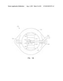 Low Profile Instrument Immobilizer diagram and image