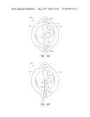 Low Profile Instrument Immobilizer diagram and image