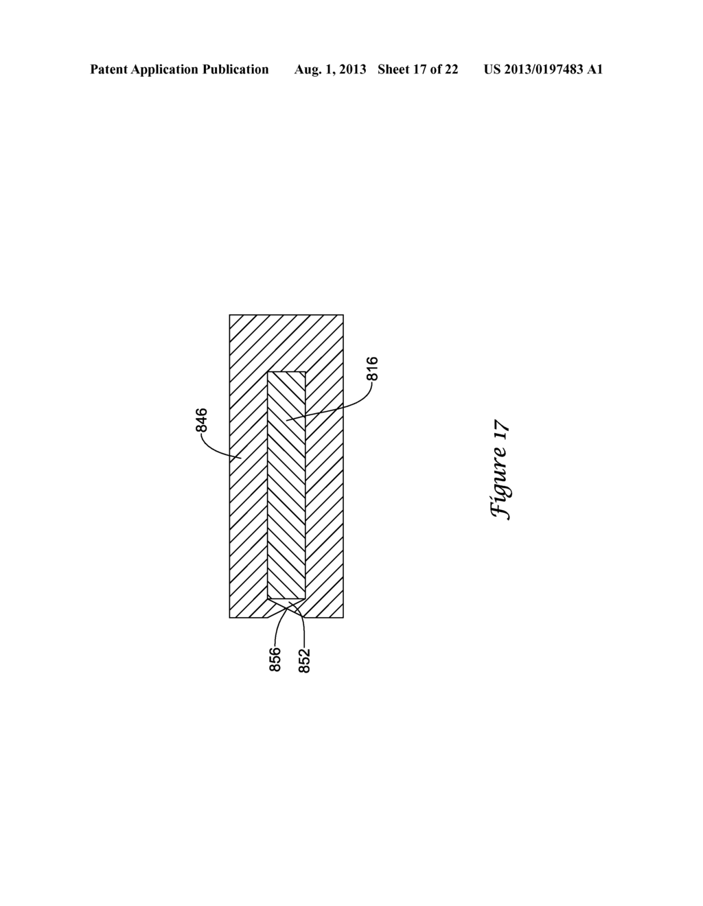 GUIDE EXTENSION CATHETER - diagram, schematic, and image 18