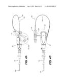 MEDICAL DEVICE HAVING A TENSIONABLE COUPLING diagram and image