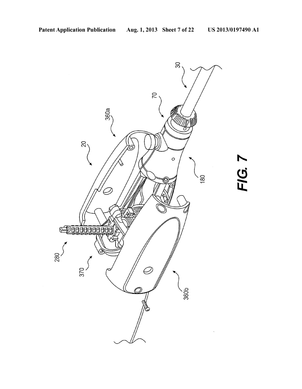 MEDICAL DEVICE HAVING A TENSIONABLE COUPLING - diagram, schematic, and image 08