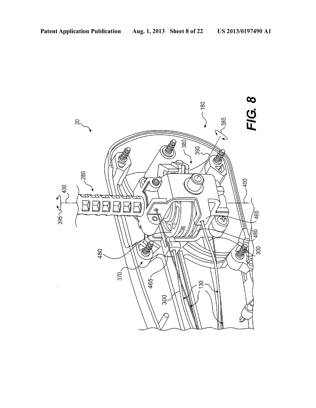 MEDICAL DEVICE HAVING A TENSIONABLE COUPLING - diagram, schematic, and image 09