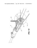 MEDICAL DEVICE HAVING A TENSIONABLE COUPLING diagram and image