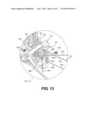 MEDICAL DEVICE HAVING A TENSIONABLE COUPLING diagram and image