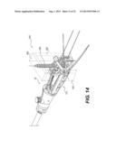 MEDICAL DEVICE HAVING A TENSIONABLE COUPLING diagram and image