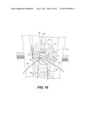 MEDICAL DEVICE HAVING A TENSIONABLE COUPLING diagram and image