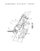 MEDICAL DEVICE HAVING A TENSIONABLE COUPLING diagram and image