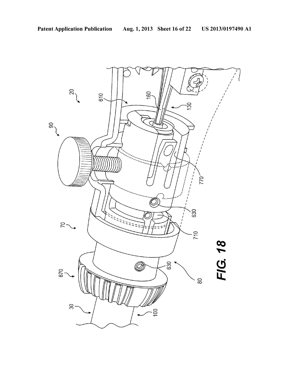 MEDICAL DEVICE HAVING A TENSIONABLE COUPLING - diagram, schematic, and image 17