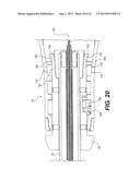 MEDICAL DEVICE HAVING A TENSIONABLE COUPLING diagram and image