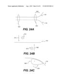MEDICAL DEVICE HAVING A TENSIONABLE COUPLING diagram and image