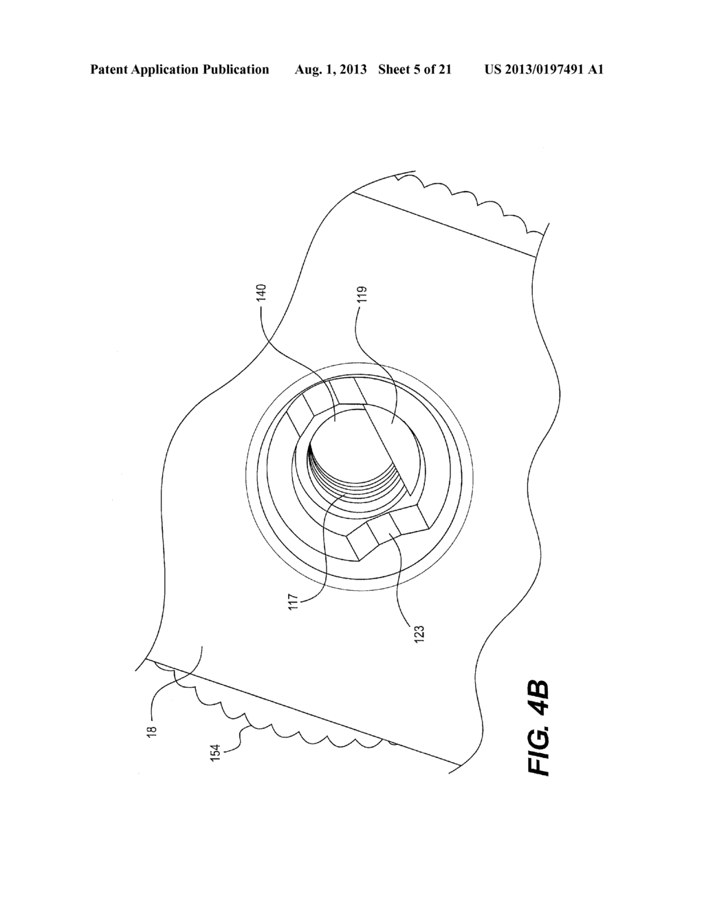 MEDICAL DEVICE HAVING A MODULAR CONTROLLER - diagram, schematic, and image 06