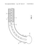 LARGE AREA CRYOABLATION CATHETER WITH MULTI-GEOMETRY TIP ECG/CRYO MAPPING     CAPABILITIES diagram and image