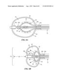 BALLOON DESIGN TO ENHANCE COOLING UNIFORMITY diagram and image