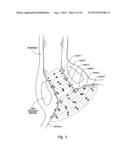 SYSTEMS AND METHODS FOR CONTROLLING USE AND OPERATION OF A FAMILY OF     DIFFERENT TREATMENT DEVICES diagram and image