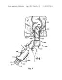 SYSTEMS AND METHODS FOR CONTROLLING USE AND OPERATION OF A FAMILY OF     DIFFERENT TREATMENT DEVICES diagram and image