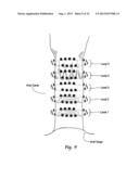 SYSTEMS AND METHODS FOR CONTROLLING USE AND OPERATION OF A FAMILY OF     DIFFERENT TREATMENT DEVICES diagram and image