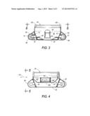 CLIP FOR RIB STABILIZATION diagram and image