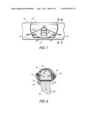 CLIP FOR RIB STABILIZATION diagram and image