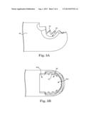 ROTARY CUTTING TOOL WITH IMPROVED CUTTING AND REDUCED CLOGGING ON SOFT     TISSUE AND THIN BONE diagram and image