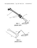 TOTAL JOINT ARTHROPLASTY SYSTEM diagram and image