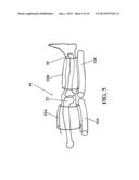 TOTAL JOINT ARTHROPLASTY SYSTEM diagram and image