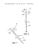 TOTAL JOINT ARTHROPLASTY SYSTEM diagram and image