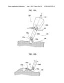 OVERCOAT TUBE diagram and image