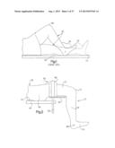 ROBOTIC ARTHROPLASTY SYSTEM INCLUDING NAVIGATION diagram and image