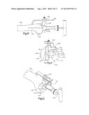 ROBOTIC ARTHROPLASTY SYSTEM INCLUDING NAVIGATION diagram and image