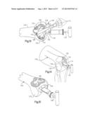 ROBOTIC ARTHROPLASTY SYSTEM INCLUDING NAVIGATION diagram and image