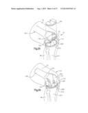 ROBOTIC ARTHROPLASTY SYSTEM INCLUDING NAVIGATION diagram and image