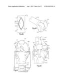 ROBOTIC ARTHROPLASTY SYSTEM INCLUDING NAVIGATION diagram and image