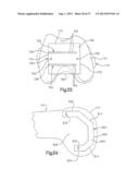 ROBOTIC ARTHROPLASTY SYSTEM INCLUDING NAVIGATION diagram and image