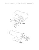 ROBOTIC ARTHROPLASTY SYSTEM INCLUDING NAVIGATION diagram and image