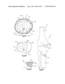 ROBOTIC ARTHROPLASTY SYSTEM INCLUDING NAVIGATION diagram and image