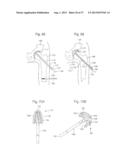 ROBOTIC ARTHROPLASTY SYSTEM INCLUDING NAVIGATION diagram and image