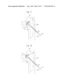 ROBOTIC ARTHROPLASTY SYSTEM INCLUDING NAVIGATION diagram and image