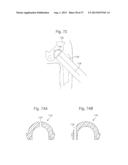 ROBOTIC ARTHROPLASTY SYSTEM INCLUDING NAVIGATION diagram and image