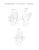 ROBOTIC ARTHROPLASTY SYSTEM INCLUDING NAVIGATION diagram and image