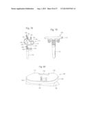 ROBOTIC ARTHROPLASTY SYSTEM INCLUDING NAVIGATION diagram and image