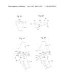 ROBOTIC ARTHROPLASTY SYSTEM INCLUDING NAVIGATION diagram and image