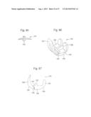 ROBOTIC ARTHROPLASTY SYSTEM INCLUDING NAVIGATION diagram and image