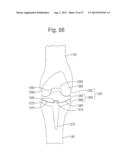 ROBOTIC ARTHROPLASTY SYSTEM INCLUDING NAVIGATION diagram and image