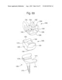 ROBOTIC ARTHROPLASTY SYSTEM INCLUDING NAVIGATION diagram and image