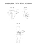 ROBOTIC ARTHROPLASTY SYSTEM INCLUDING NAVIGATION diagram and image