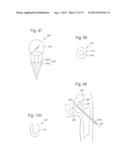 ROBOTIC ARTHROPLASTY SYSTEM INCLUDING NAVIGATION diagram and image