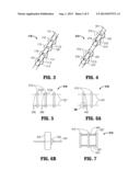 Wound Closure Device diagram and image